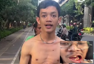 Pemotor di Jakpus Luka Robek Dipukul Tanpa Alasan, Pelaku Telanjang Dada Ajak Berkelahi di Jalan