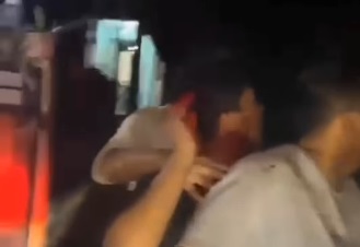 Kepala Remaja Berdarah-darah Dipukul Airsoft Gun Saat Bangunkan Sahur di Bogor, Pelaku Sempat Umbar Tembakan